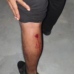 Businessman shot as gunmen terrorize Festival City family