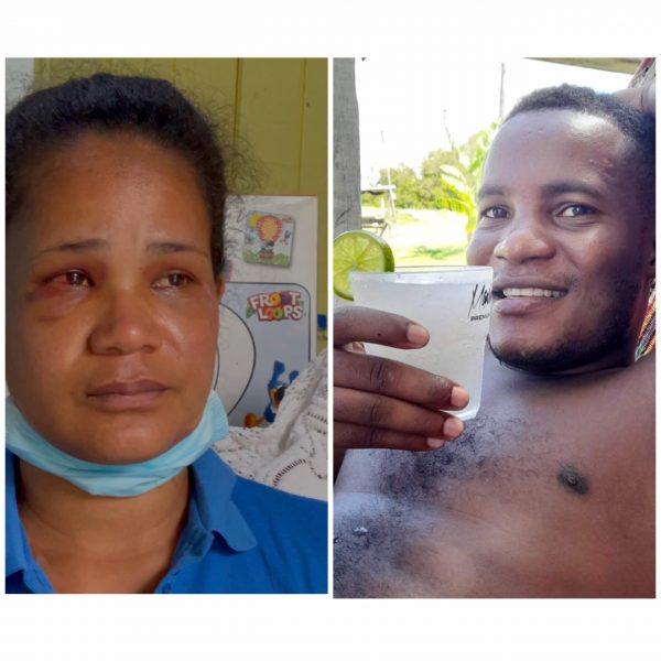 Abuser is back! more blows, child injured after woman drops charges